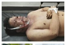 Viral…!!! Launching Diskotik BN Binjai, Salah Satu Pengunjung Tewas Diduga Over Dosis